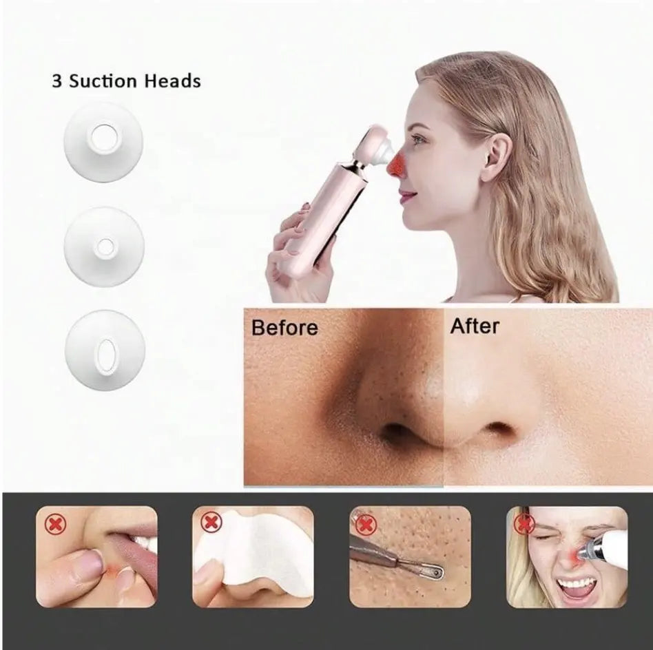 Black Head Remover